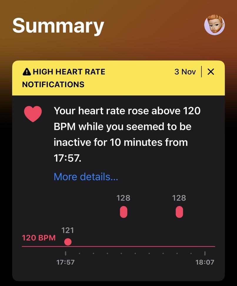 Heart rate